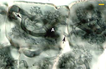 Arbuscules from coils (14KB)