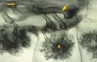 hyphal coils and arbuscules (11KB)