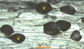 Vesicles in Glomus (14KB)