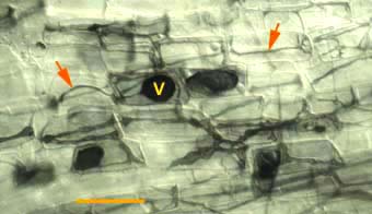 Saprophytic vesicles (13KB)