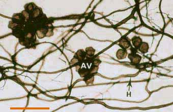 Soil hyphae with auxiliary cells (14KB)